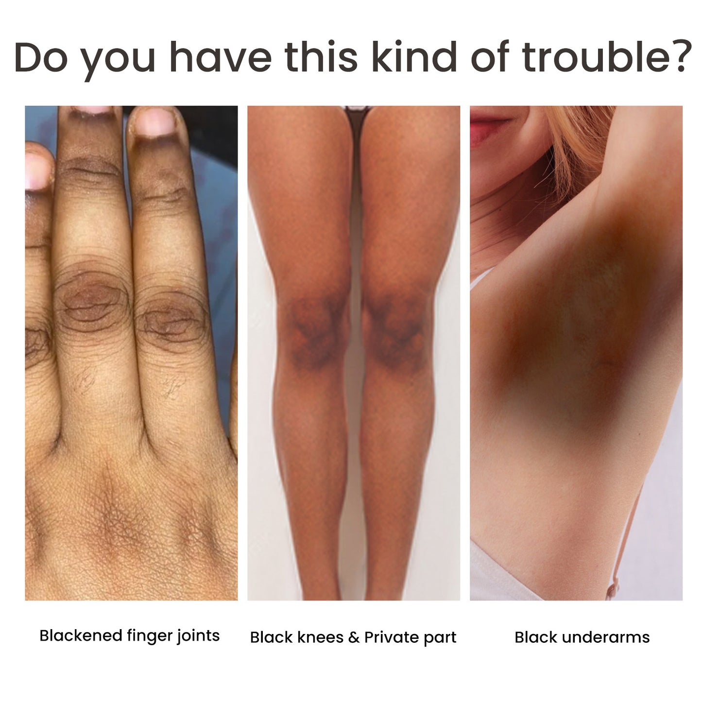 Women's Skin Pigmentation Treatment – Brightening & Even Tone Care