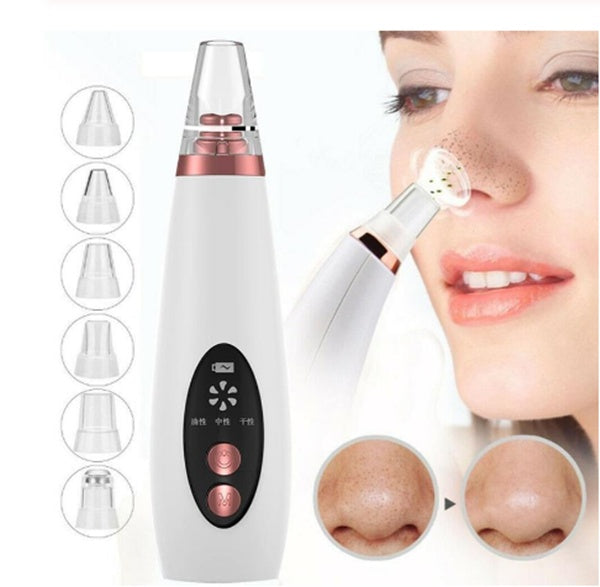 Pore Cleaning Artifact – Household Blackhead Suction Device for Deep Skin Cleansing