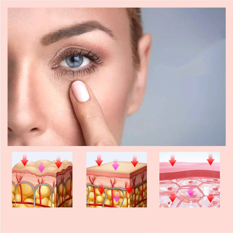 Professional Eye Rejuvenation Device – Advanced Anti-Aging Treatment for Puffiness, Dark Circles & Youthful Eyes
