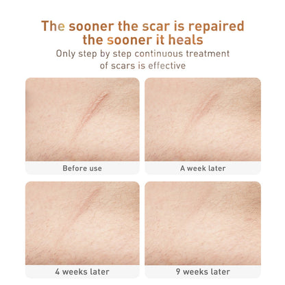 Advanced Herbal Scar Removal Cream - Traditional Chinese Medicine Formula for Skin Repair & Healing