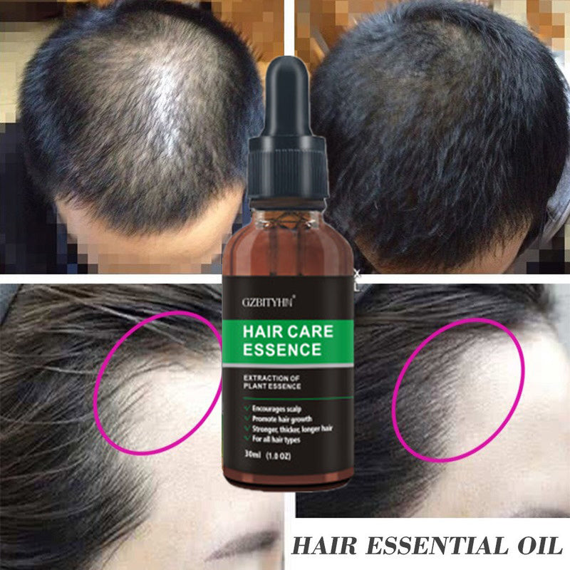 Advanced Hair Growth Oil - Natural Formula for Thicker, Stronger Hair & Scalp Nourishment