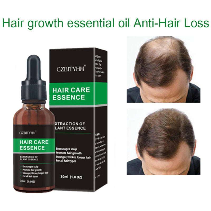 Advanced Hair Growth Oil - Natural Formula for Thicker, Stronger Hair & Scalp Nourishment