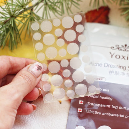 Advanced Acne Spot Treatment Patches - Invisible Blemish Healing with Bonus Skincare Cream