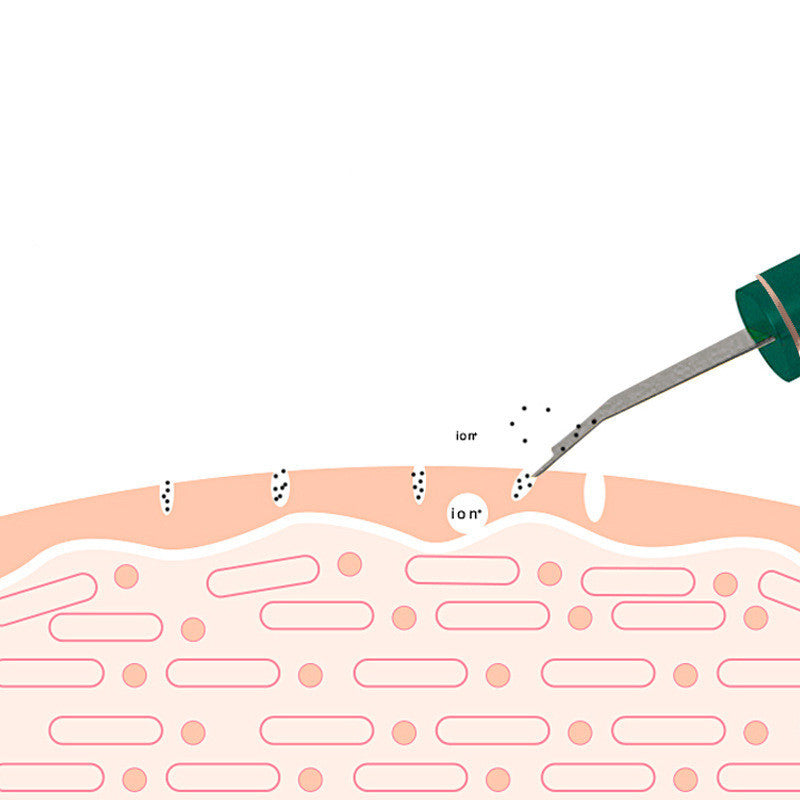 Professional Ultrasonic Skin Scrubber – Advanced Facial Device for Deep Cleansing, Exfoliation & Skin Rejuvenation