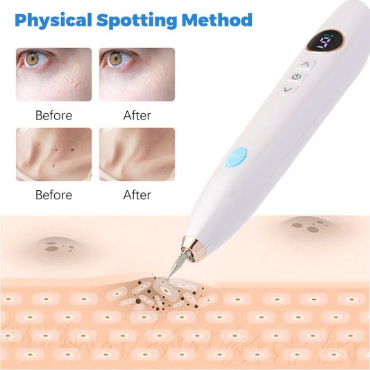 Professional Plasma Pen Device – Advanced Laser Technology for Skin Tag, Mole & Blemish Removal at Home