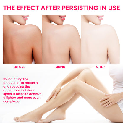 Women's Skin Pigmentation Treatment – Brightening & Even Tone Care